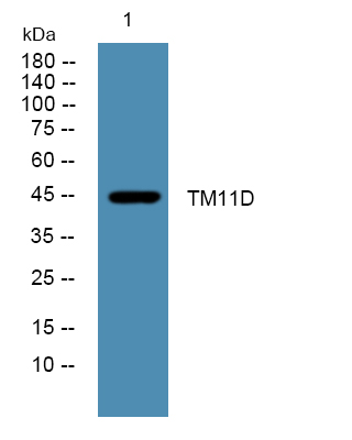Western blot analysis of lysates from HCT116 cells, primary antibody was diluted at 1:1000, 4°over night