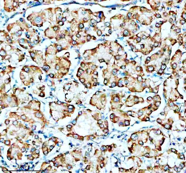 a10635 2 smg8 primary antibodies ihc testing 1