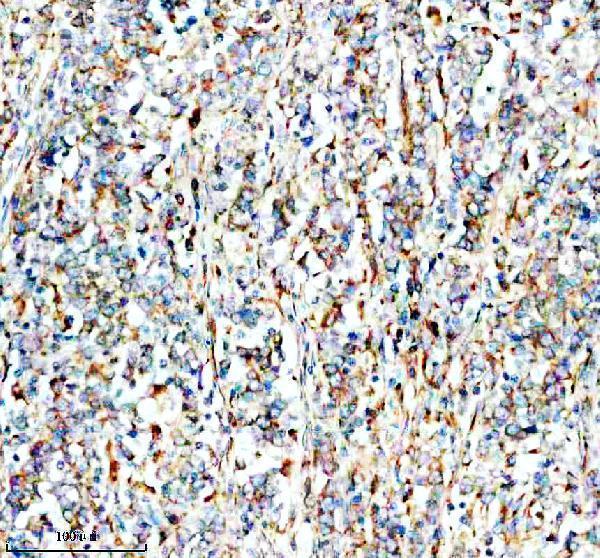 a10635 2 smg8 primary antibodies ihc testing 3