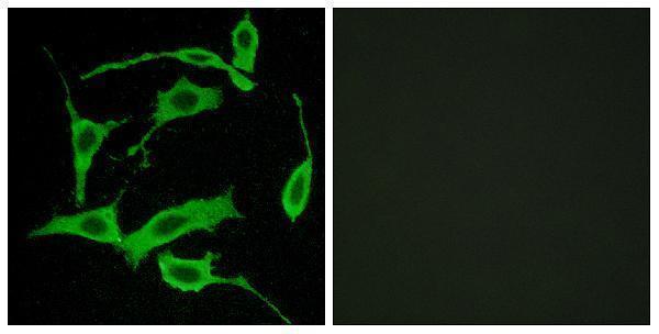 Immunofluorescence analysis of LOVO cells, using GPR85 Antibody