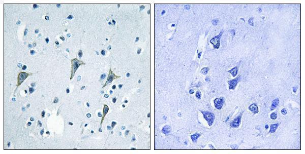 Immunohistochemistry analysis of paraffin-embedded human brain tissue, using GPR85 Antibody