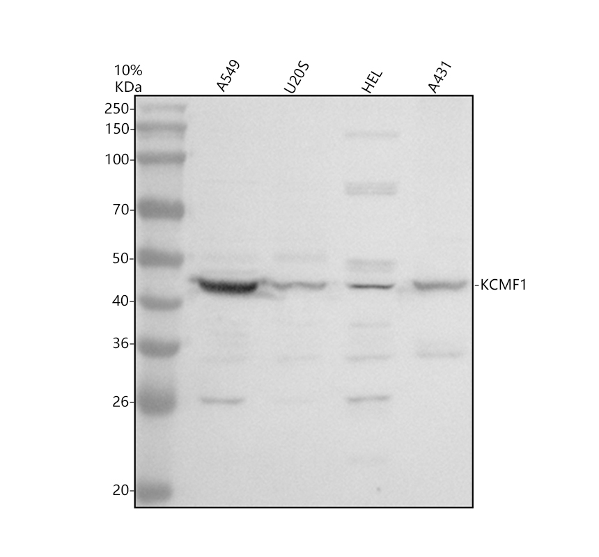Western blot analysis of KCMF1 using anti-KCMF1 antibody (A10644-1)