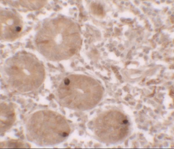 a10646 mterfd2 primary antibodies ihc testing 2