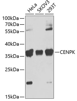Western blot analysis of extracts of various cell lines, using CENPK Antibody  at 1:1000 dilution