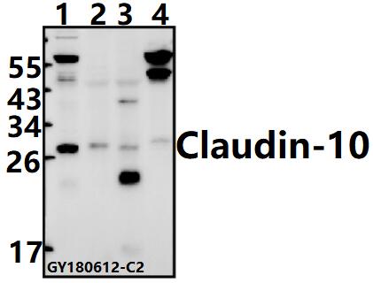 Western blot (WB) analysis of Claudin-10 (N217) pAb at 1:500 dilution
Lane1:Hela whole cell lysate(40ug)
Lane2:The Kidney tissue lysate of Mouse(40ug)
Lane3:The Kidney tissue lysate of Rat(40ug)
Lane4:K562 whole cell lysate(40ug)