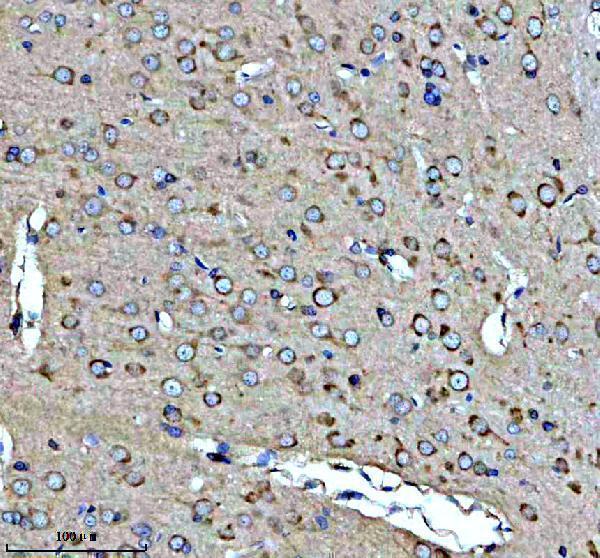 a10654 1 fkbp2 primary antibodies ihc testing 4