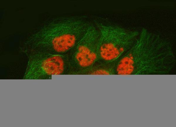 a10655 1 snrpa1 primary antibodies if testing 13