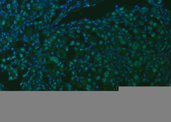 a10655 1 snrpa1 primary antibodies if testing 14