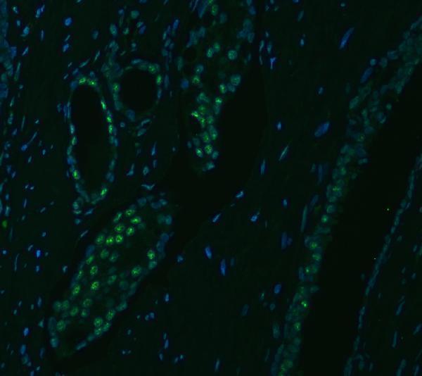 a10655 1 snrpa1 primary antibodies if testing 15