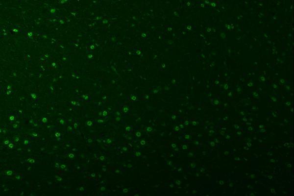 a10655 1 snrpa1 primary antibodies if testing 16