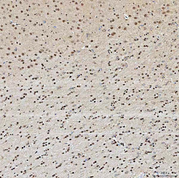 a10655 1 snrpa1 primary antibodies ihc testing 11