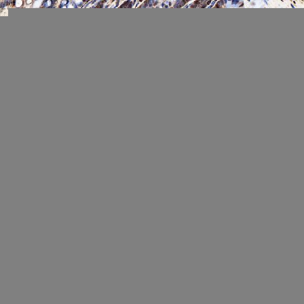 a10655 1 snrpa1 primary antibodies ihc testing 12
