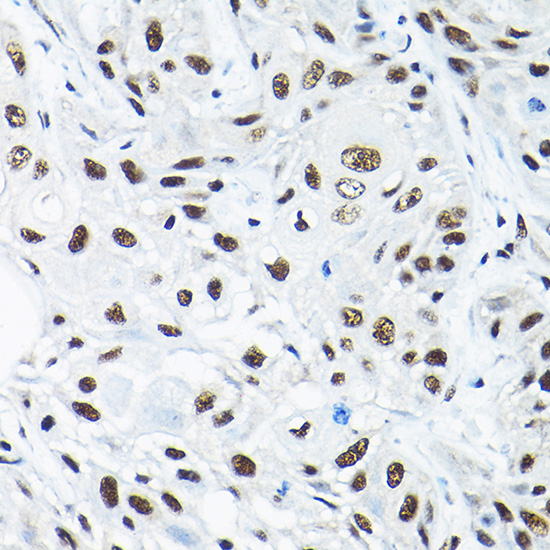 a10655 snrpa1 primary antiboties ihc testing 2