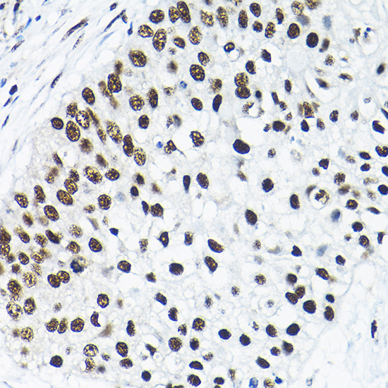 a10655 snrpa1 primary antiboties ihc testing 3