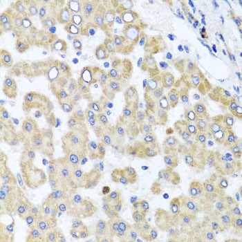 Immunoprecipitation analysis of 200ug extracts of MCF-7 cells, using 3 ug RAB24 antibody 