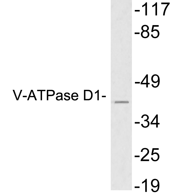 Western blot analysis of lysates from HeLa cells, using V-ATPase D1 antibody