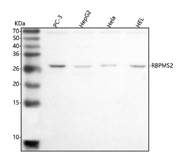 Figure 1. Western blot analysis of RBPMS2 using anti-RBPMS2 antibody (A10660-1). Electrophoresis was performed on a 5-20% SDS-PAGE gel at 70V (Stacking gel) / 90V (Resolving gel) for 2-3 hours. The sample well of each lane was loaded with 30 ug of sample under reducing conditions. Lane 1: human PC-3 whole cell lysates, Lane 2: human HepG2 whole cell lysates, Lane 3: human Hela whole cell lysates, Lane 4: human HEL whole cell lysates. After electrophoresis, proteins were transferred to a nitrocellulose membrane at 150 mA for 50-90 minutes. Blocked the membrane with 5% non-fat milk/TBS for 1.5 hour at RT. The membrane was incubated with rabbit anti-RBPMS2 antigen affinity purified polyclonal antibody (Catalog # A10660-1) at 0.5 microg/mL overnight at 4°C, then washed with TBS-0.1%Tween 3 times with 5 minutes each and probed with a goat anti-rabbit IgG-HRP secondary antibody at a dilution of 1:5000 for 1.5 hour at RT. The signal is developed using an Enhanced Chemiluminescent detection (ECL) kit (Catalog # EK1002) with Tanon 5200 system. A specific band was detected for RBPMS2 at approximately 28 kDa. The expected band size for RBPMS2 is at 22 kDa.