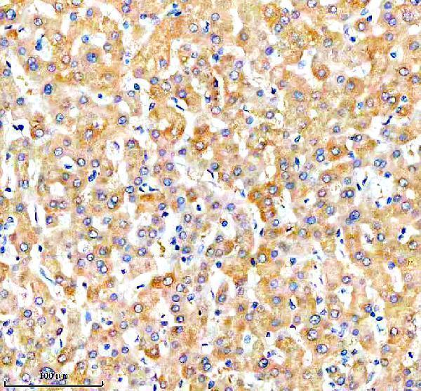 a10663 1 nudt7 primary antibodies ihc testing 2