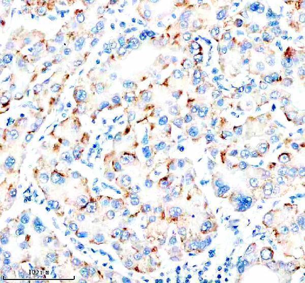 a10663 1 nudt7 primary antibodies ihc testing 3