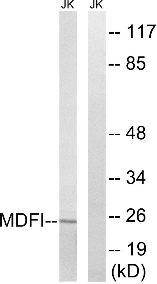 Western blot analysis of lysates from Jurkat cells, using MDFI Antibody