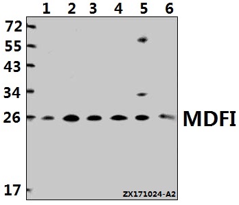 Western blot (WB) analysis of MDFI (P134) pAb at 1:500 dilution
Lane1:SGC7901 whole cell lysate(40ug)
Lane2:PC3 whole cell lysate(40ug)
Lane3:HepG2 whole cell lysate(40ug)
Lane4:HCT116 whole cell lysate(40ug)
Lane5:C6 whole cell lysate(40ug)
Lane6:3T3-L1 whole cell lysate(40ug)