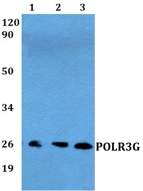 Western blot (WB) analysis of POLR3G polyclonal antibody at 1:500 dilution
Lane1:MCF-7 whole cell lysate
Lane2:Raw264