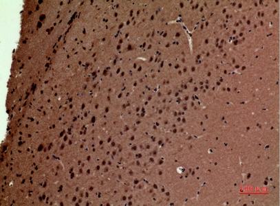 a10669 polr3g primary antibodyes ihc testing 1