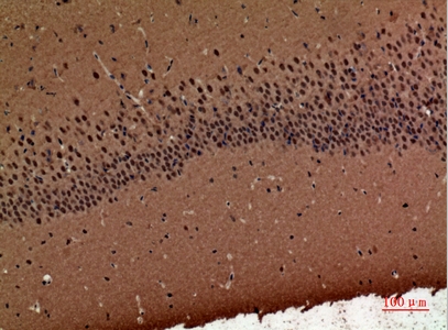 a10669 polr3g primary antibodyes ihc testing 3