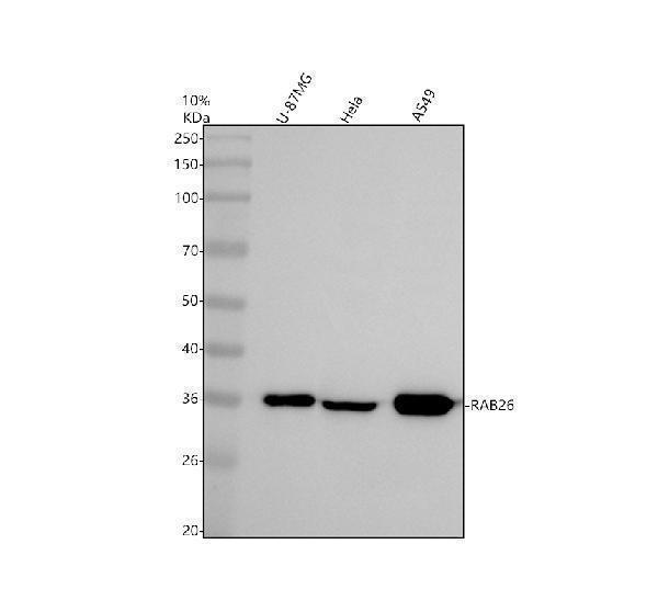 Western blot analysis of RAB26 using anti-RAB26 antibody (A10670-2)
