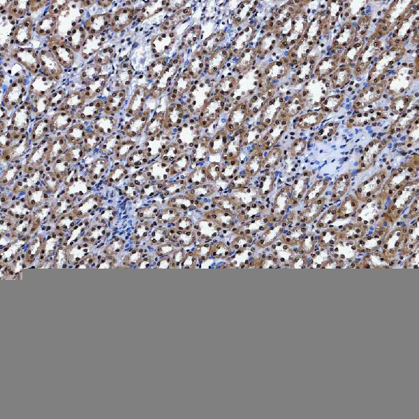 a10671 1 sf3a3 primary antibodies ihc testing 11