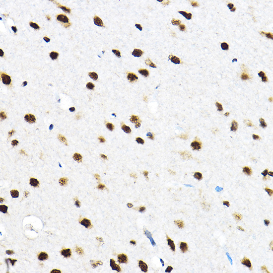Immunohistochemistry of paraffin-embedded rat brain using SF3A3 Rabbit pAb  at dilution of 1:100 