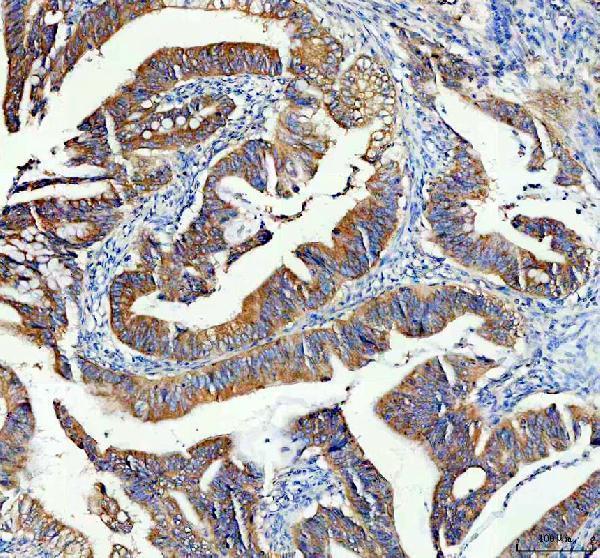 a10672 rps28 primary antibodies ihc testing 2