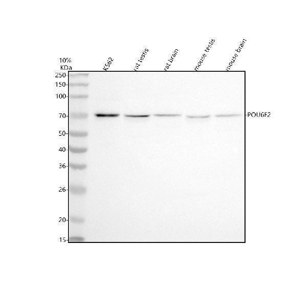  Western blot analysis of POU6F2 using anti-POU6F2 antibody (A10673-2)