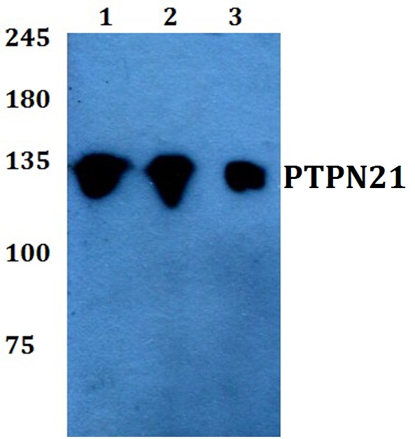 Western blot (WB) analysis of PTPN21 polyclonal antibody at 1:500 dilution
Lane1:A549 whole cell lysate
Lane2:Raw264