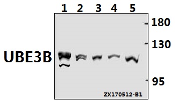 Western blot (WB) analysis of UBE3B polyclonal antibody at 1:500 dilution
Lane1:PC12 whole cell lysate(40ug)
Lane2:CT26 whole cell lysate(40ug)
Lane3:SGC7901 whole cell lysate(40ug)
Lane4:MCF-7 whole cell lysate(40ug)
Lane5:HEK293T whole cell lysate(40ug)