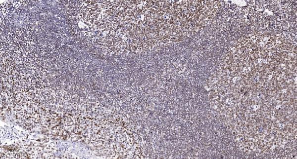 a10679 ube3b primary antibodies ihc testing 1