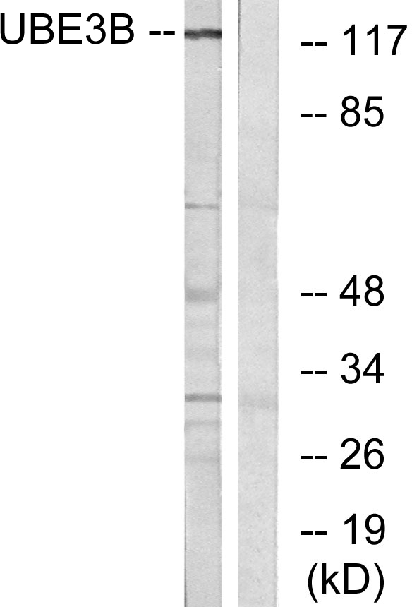 a10679 ube3b primary antibodies wb testing 2