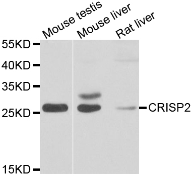 Western blot analysis of extracts of various cell lines, using CRISP2 antibody