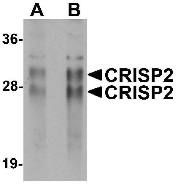 Western blot analysis of CRISP2 in human testis tissue lysate with CRISP2 antibody at (A) 0