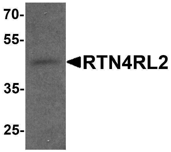 a10682 rtn4rl2 primary antibodies wb testing 1