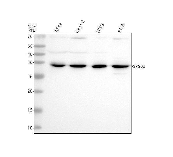 Western blot analysis of SPSB2 using anti-SPSB2 antibody (A10691-1)