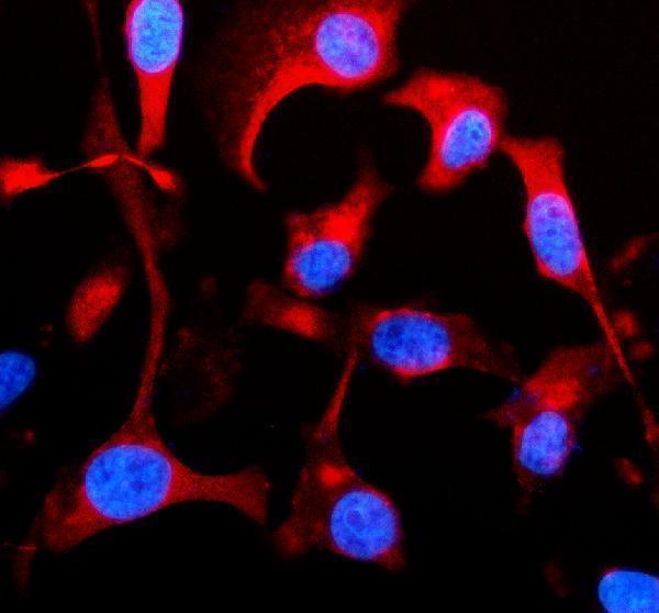 a10692 1 glp2r primary antibodies if testing 1