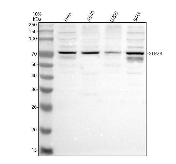 a10692 1 glp2r primary antibodies wb testing 1