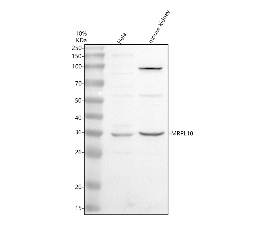 Western blot analysis of MRPL10 using anti-MRPL10 antibody (A10693-3)