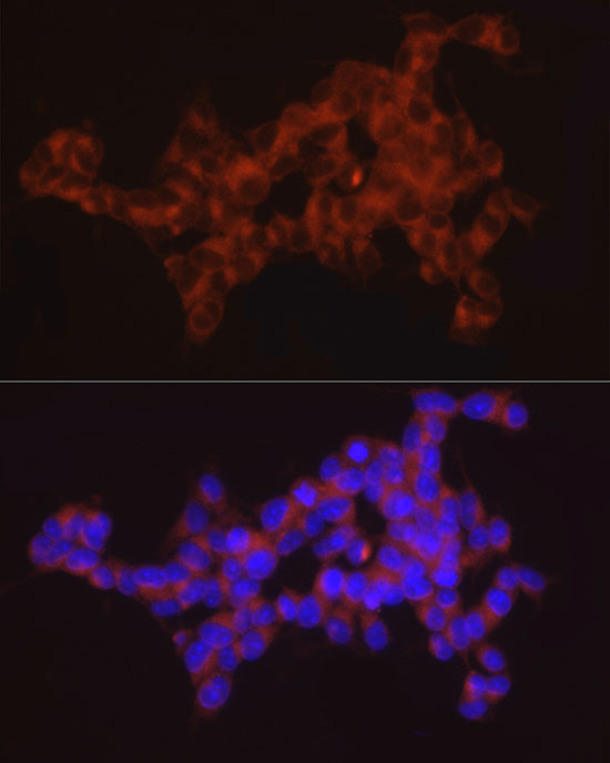 a10695 2 syt11 primary antiboties if testing 4