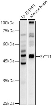 Western blot analysis of extracts of various cell lines, using SYT11 antibody  at 1:670 dilution