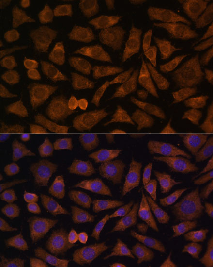 a10697 rabif primary antiboties if testing 2