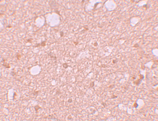 a10698 sestd1 primary antibodies ihc testing 2