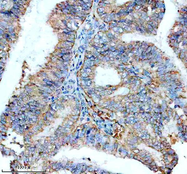 IHC analysis of ST3GAL2 using anti-ST3GAL2 antibody (A10700-1)
