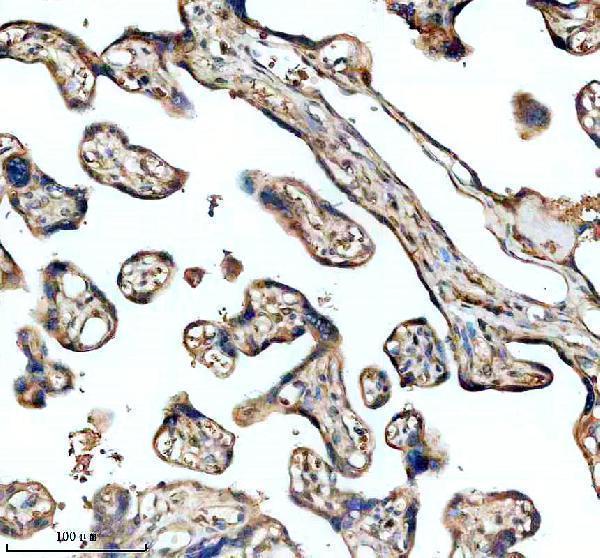 IHC analysis of ST3GAL2 using anti-ST3GAL2 antibody (A10700-1)